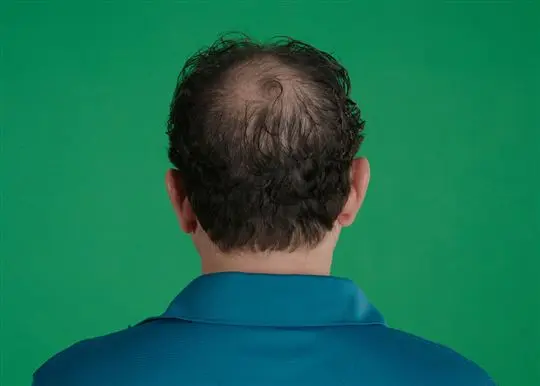 Hair Grow Max Gary pre